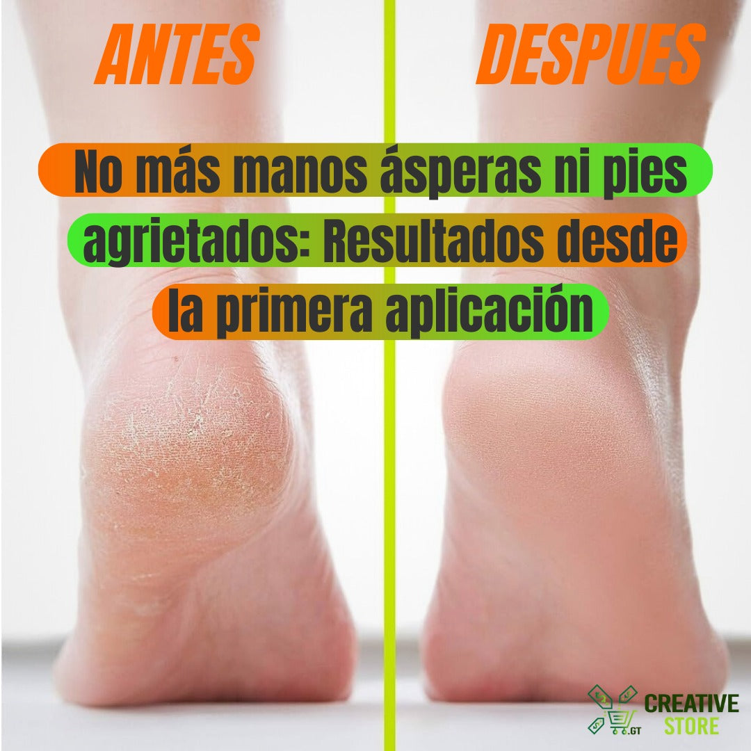 🔥2X1 ¡SUPER MEGA PROMOCIÓN!🔥CREMA HIDRATANTE PARA PIEL AGRIETADA 2X1 + OBSEQUIOS CON ENVIÓ GRATIS