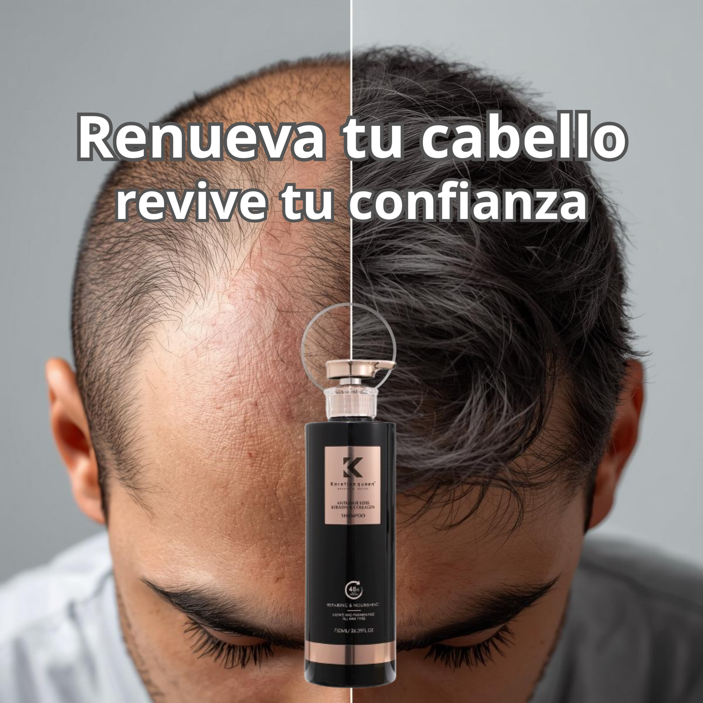 💫 ¡Transformá tu Cabello por solo Q199! Shampoo Anti Caída y Crecimiento ✨ Fuerza, volumen y salud para tu cabello 🚚 Envío GRATIS + Pago contra entrega