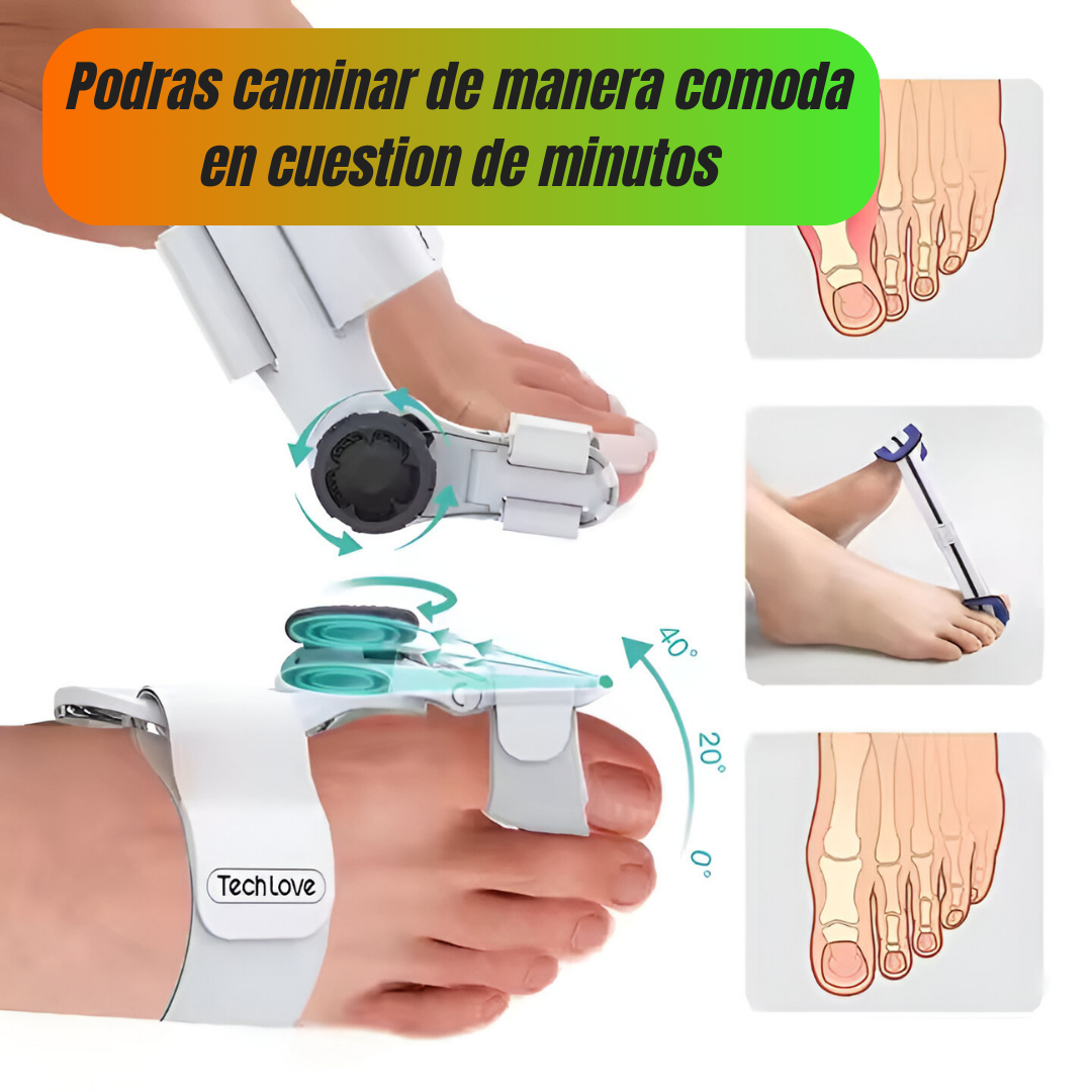 ✨ ¡Lleva tu Corrector Ortopédico para Juanetes por solo Q200 y recibe REGALOS EXCLUSIVOS + ENVÍO GRATIS! ✨